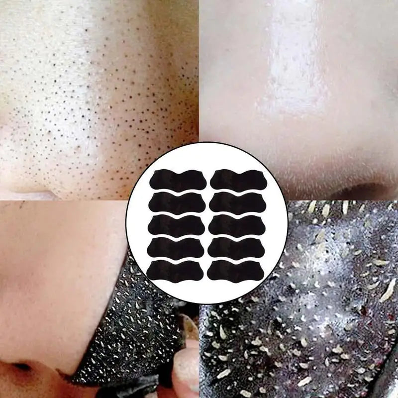 Blackhead Mask Peel Nasal Strips